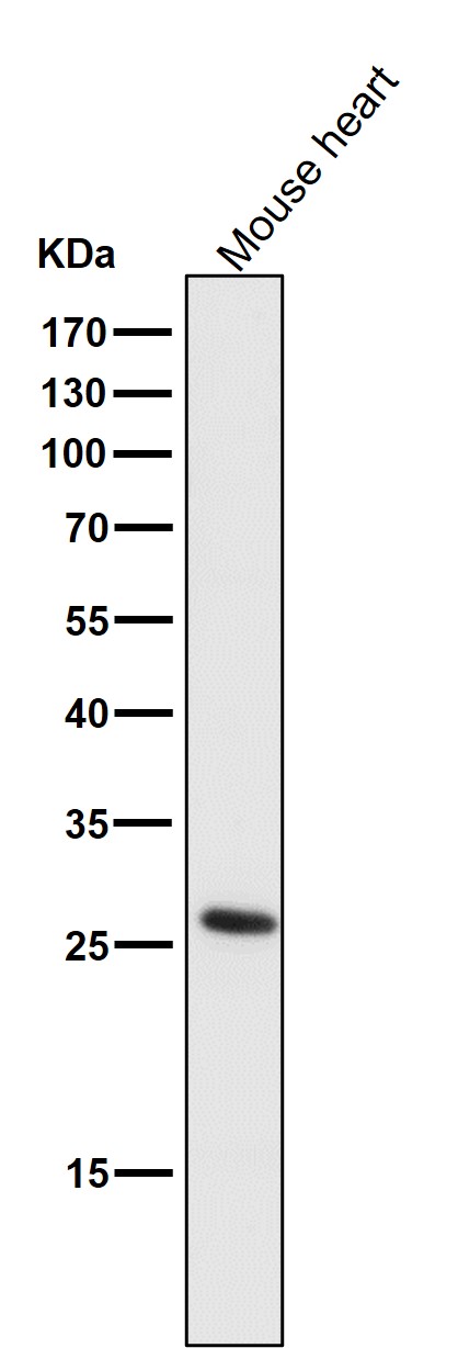 1 - Anti-CD20 MS4A1 Rabbit Monoclonal Antibody ABO13318