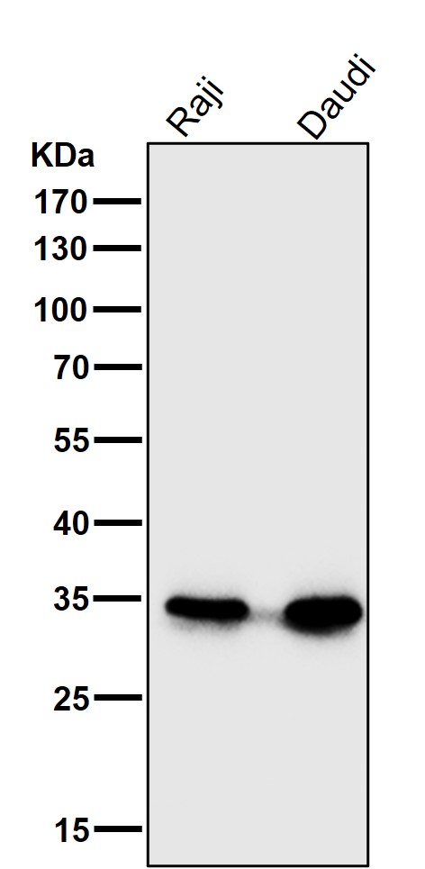 1 - Anti-CD20 MS4A1 Rabbit Monoclonal Antibody ABO13318