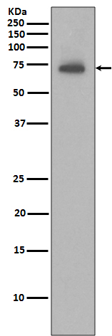 1 - Anti-IAP2 BIRC3 Rabbit Monoclonal Antibody ABO13319