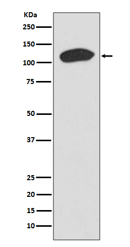 1 - Anti-KAP1 TRIM28 Rabbit Monoclonal Antibody ABO13320