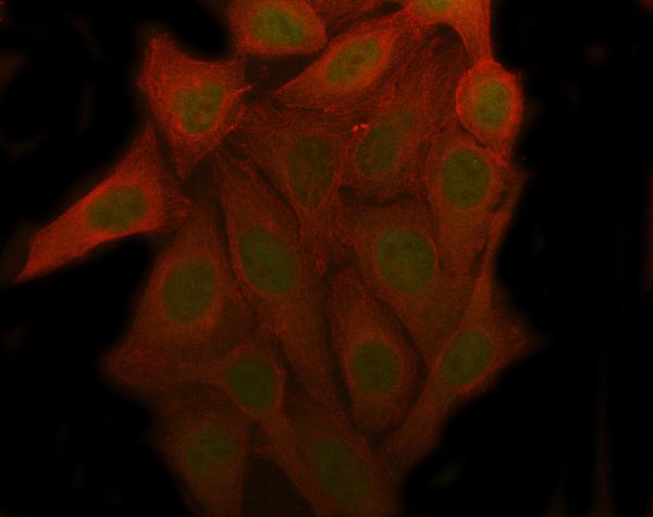 3 - Anti-CDK1/Cdc2 Rabbit Monoclonal Antibody ABO13321