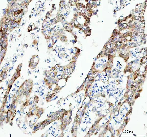 2 - Anti-CDK1/Cdc2 Rabbit Monoclonal Antibody ABO13321