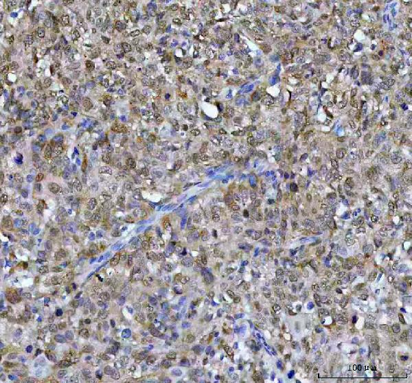 2 - Anti-CDK1/Cdc2 Rabbit Monoclonal Antibody ABO13321