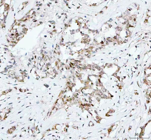 2 - Anti-CDK1/Cdc2 Rabbit Monoclonal Antibody ABO13321
