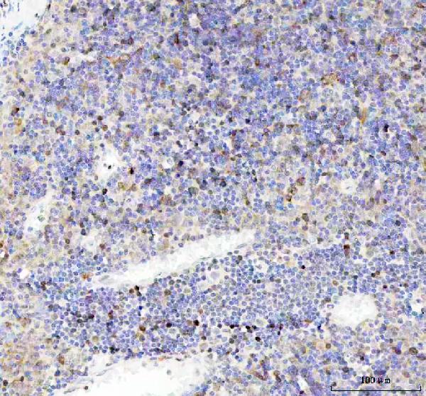 2 - Anti-CDK1/Cdc2 Rabbit Monoclonal Antibody ABO13321