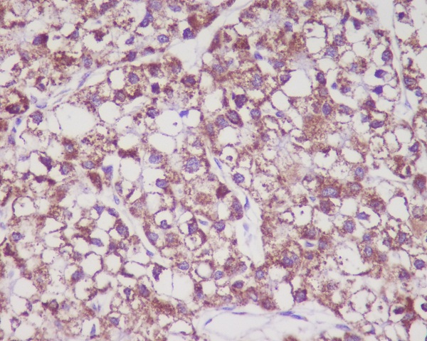 2 - Anti-MMP3 Rabbit Monoclonal Antibody ABO13323