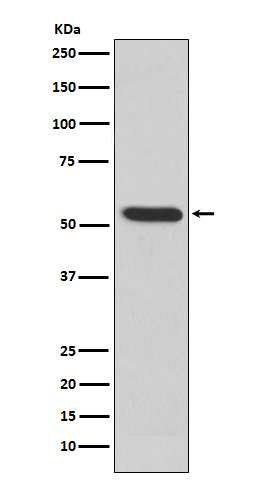 1 - Anti-MMP3 Rabbit Monoclonal Antibody ABO13323