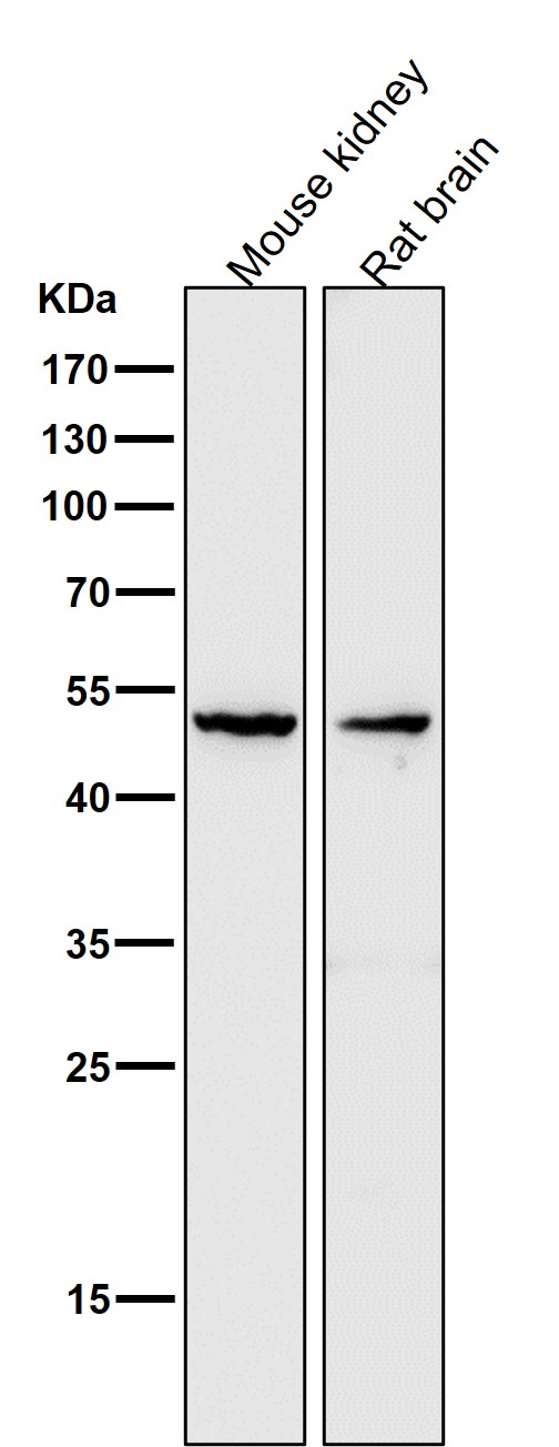 1 - Anti-MMP3 Rabbit Monoclonal Antibody ABO13323