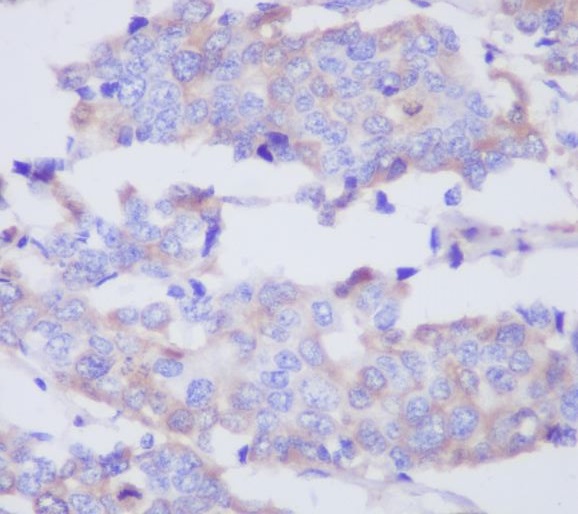 2 - Anti-MMP2 Rabbit Monoclonal Antibody ABO13324