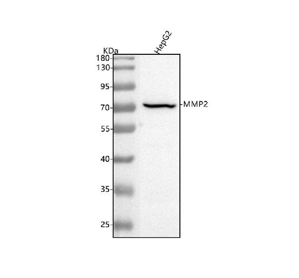 1 - Anti-MMP2 Rabbit Monoclonal Antibody ABO13324