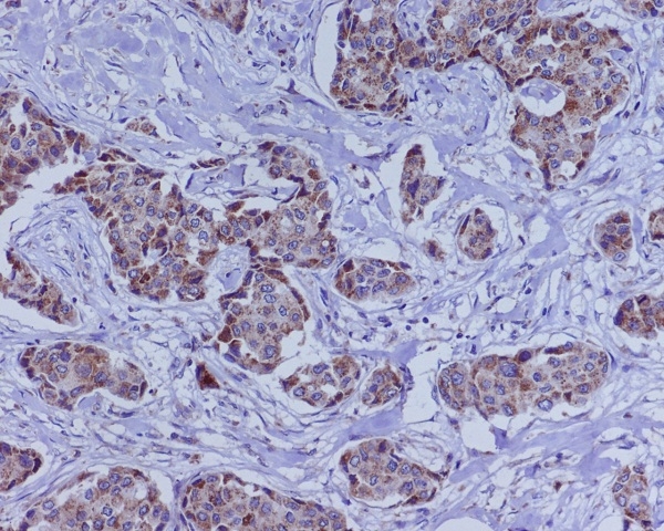 2 - Anti-BMP4 Rabbit Monoclonal Antibody ABO13325