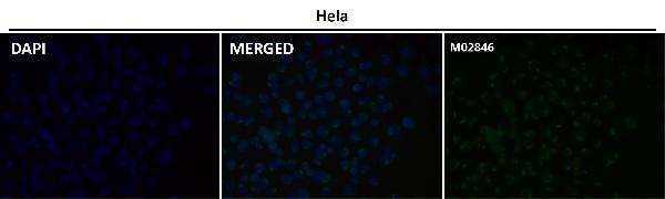 1 - Anti-PSMA FOLH1 Rabbit Monoclonal Antibody ABO13326