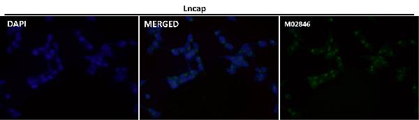 1 - Anti-PSMA FOLH1 Rabbit Monoclonal Antibody ABO13326