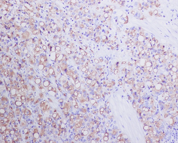 2 - Anti-PSMA FOLH1 Rabbit Monoclonal Antibody ABO13326