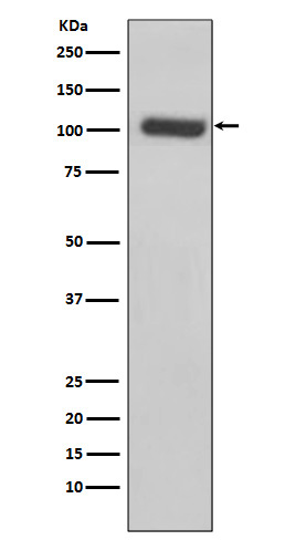 1 - Anti-PSMA FOLH1 Rabbit Monoclonal Antibody ABO13326