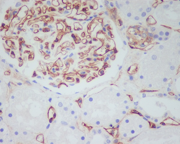 2 - Anti-CD34 Rabbit Monoclonal Antibody ABO13327