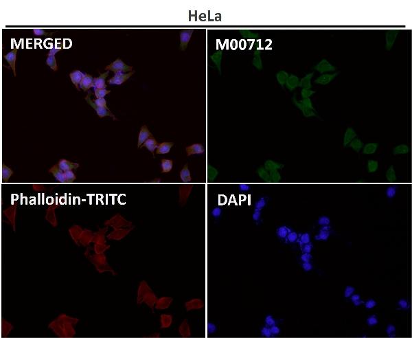 1 - Anti-MCL1 Rabbit Monoclonal Antibody ABO13328