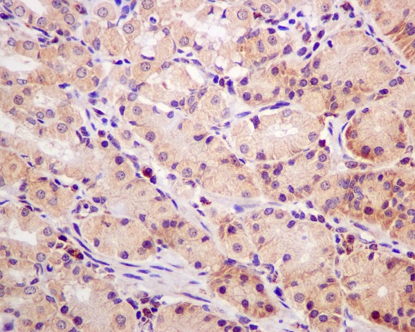 2 - Anti-MCL1 Rabbit Monoclonal Antibody ABO13328