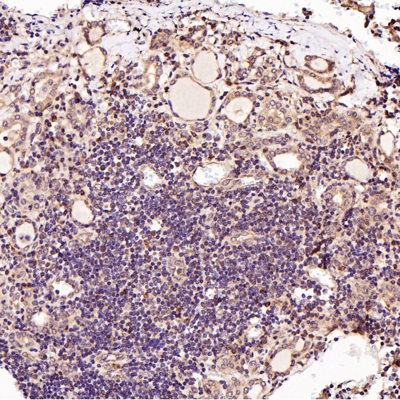 2 - Anti-MCL1 Rabbit Monoclonal Antibody ABO13328