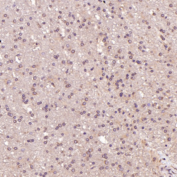 2 - Anti-MCL1 Rabbit Monoclonal Antibody ABO13328
