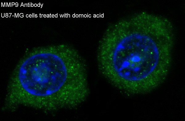 3 - Anti-MMP9 Rabbit Monoclonal Antibody ABO13330