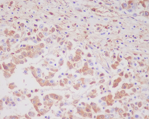 2 - Anti-MMP9 Rabbit Monoclonal Antibody ABO13330