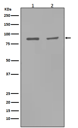 1 - Anti-MMP9 Rabbit Monoclonal Antibody ABO13330