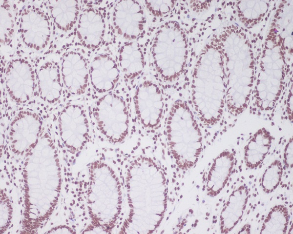 2 - Anti-Pax2 Rabbit Monoclonal Antibody ABO13331