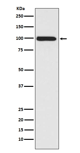 1 - Anti-LRP1/Lrp 1 Cluster Ii Rabbit Monoclonal Antibody ABO13332