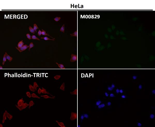 1 - Anti-LRP1/Lrp 1 Cluster Ii Rabbit Monoclonal Antibody ABO13332