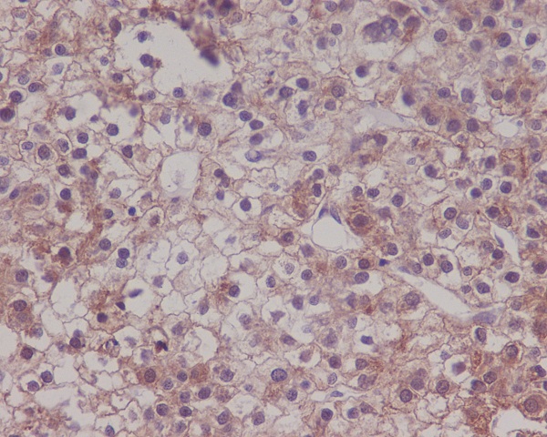 2 - Anti-LRP1/Lrp 1 Cluster Ii Rabbit Monoclonal Antibody ABO13332