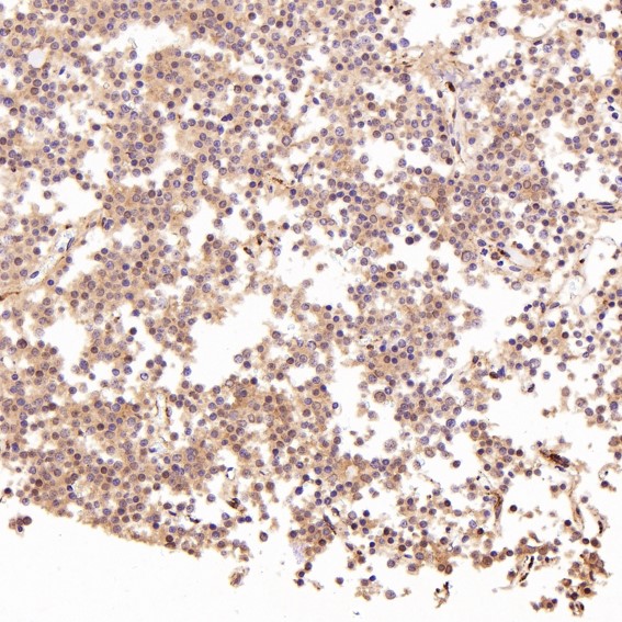 2 - Anti-LRP1/Lrp 1 Cluster Ii Rabbit Monoclonal Antibody ABO13332