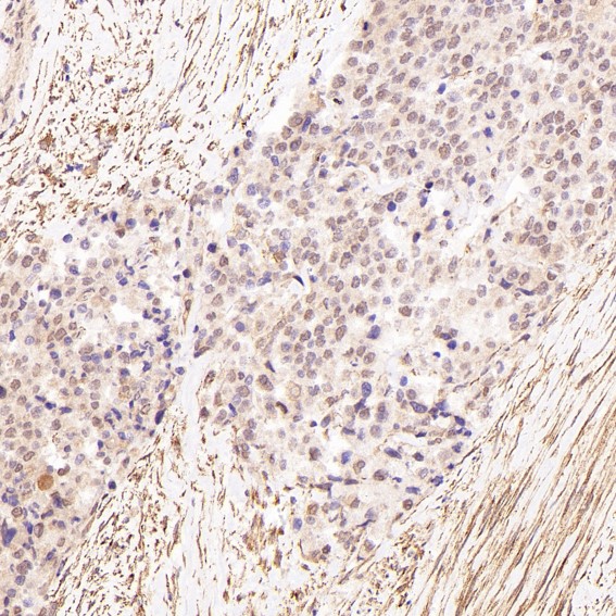 2 - Anti-LRP1/Lrp 1 Cluster Ii Rabbit Monoclonal Antibody ABO13332