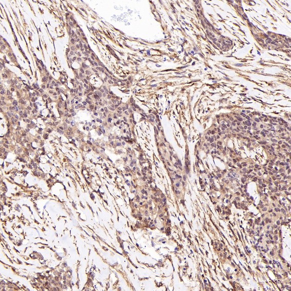 2 - Anti-LRP1/Lrp 1 Cluster Ii Rabbit Monoclonal Antibody ABO13332