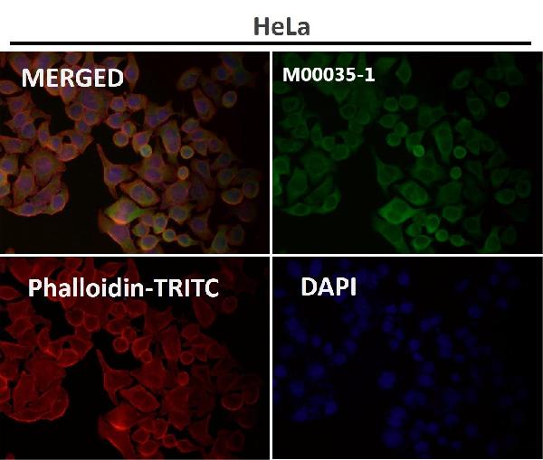 1 - Anti-BDNF Rabbit Monoclonal Antibody ABO13335