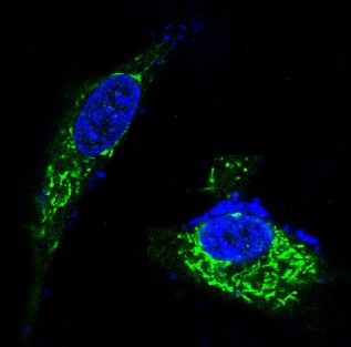3 - Anti-BDNF Rabbit Monoclonal Antibody ABO13335