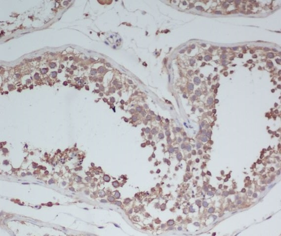2 - Anti-BDNF Rabbit Monoclonal Antibody ABO13335