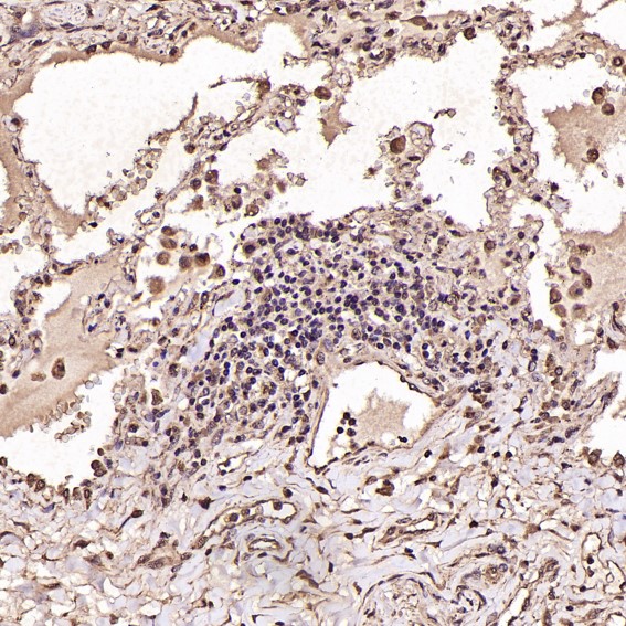 2 - Anti-BDNF Rabbit Monoclonal Antibody ABO13335