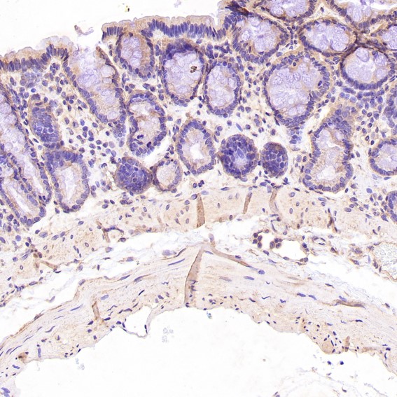 2 - Anti-BDNF Rabbit Monoclonal Antibody ABO13335