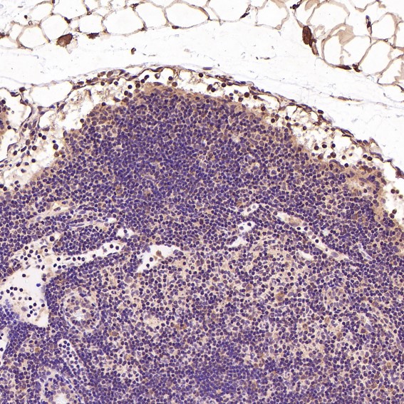 2 - Anti-BDNF Rabbit Monoclonal Antibody ABO13335