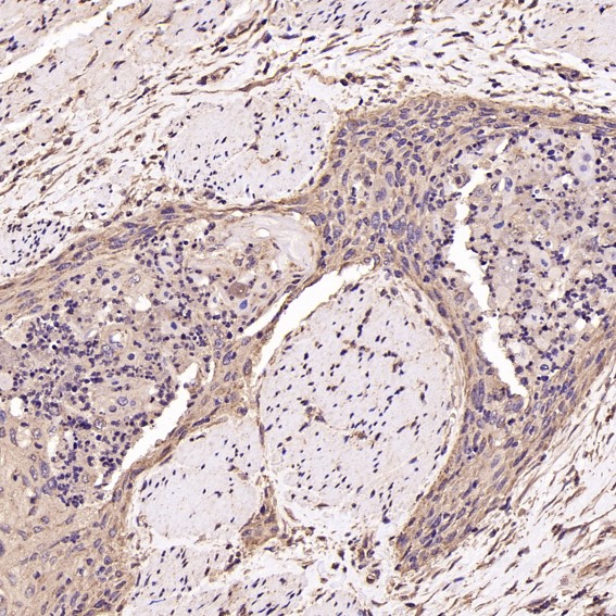 2 - Anti-BDNF Rabbit Monoclonal Antibody ABO13335