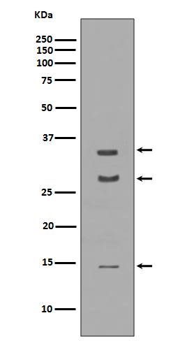 1 - Anti-BDNF Rabbit Monoclonal Antibody ABO13335