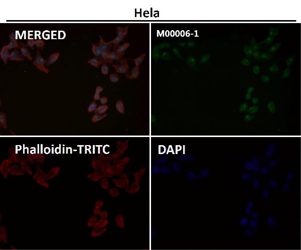 1 - Anti-PTEN Rabbit Monoclonal Antibody ABO13336