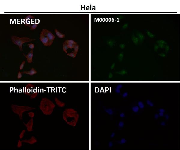 1 - Anti-PTEN Rabbit Monoclonal Antibody ABO13336