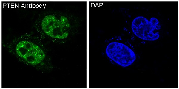 3 - Anti-PTEN Rabbit Monoclonal Antibody ABO13336