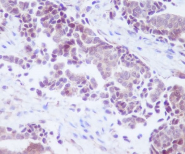 2 - Anti-PTEN Rabbit Monoclonal Antibody ABO13336