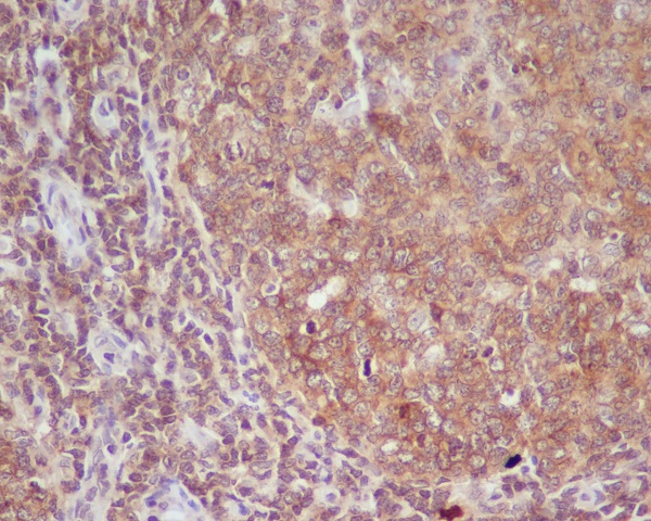 2 - Anti-CD86/B7 2 Rabbit Monoclonal Antibody ABO13337