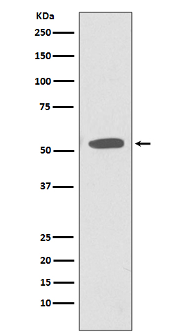 1 - Anti-CD47 Rabbit Monoclonal Antibody ABO13338