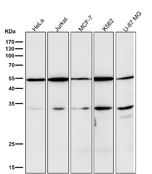 1 - Anti-CD47 Rabbit Monoclonal Antibody ABO13338