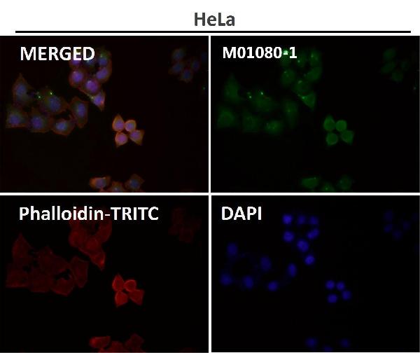 1 - Anti-CD63 Rabbit Monoclonal Antibody ABO13340
